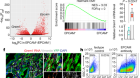 GREM1 is required to maintain cellular heterogeneity in pancreatic cancer