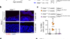 ADAR1 prevents autoinflammation by suppressing spontaneous ZBP1 activation