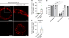Oocytes maintain ROS-free mitochondrial metabolism by suppressing complex I