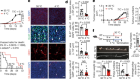 Brown-fat-mediated tumour suppression by cold-altered global metabolism