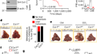 Collagenolysis-dependent DDR1 signalling dictates pancreatic cancer outcome