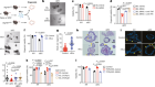 The γδ IEL effector API5 masks genetic susceptibility to Paneth cell death