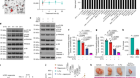 Colon tumour cell death causes mTOR dependence by paracrine P2X4 stimulation