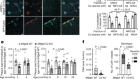 Medin co-aggregates with vascular amyloid-β in Alzheimer’s disease