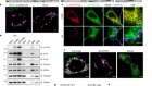 CLSTN3β enforces adipocyte multilocularity to facilitate lipid utilization