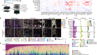 Single-cell spatial immune landscapes of primary and metastatic brain tumours