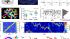Population dynamics of head-direction neurons during drift and reorientation