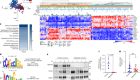 RBFOX2在胰腺癌中调节选择性剪接的转移特征