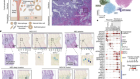 Spatial multiomics map of trophoblast development in early pregnancy