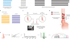 Extrachromosomal DNA in the cancerous transformation of Barrett’s oesophagus