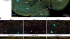 Myelin dysfunction drives amyloid-β deposition in models of Alzheimer’s disease