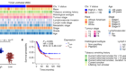 Y chromosome loss in cancer drives growth by evasion of adaptive immunity