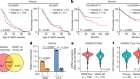 组蛋白demethylase KDM5D upregulation驱动器在结肠癌的性别差异