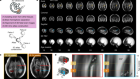 Normative spatiotemporal fetal brain maturation with satisfactory development at 2 years