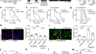 Glioma synapses recruit mechanisms of adaptive plasticity