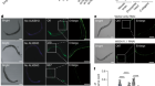 m1A in CAG repeat RNA binds to TDP-43 and induces neurodegeneration