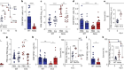 Lung dendritic-cell metabolism underlies susceptibility to viral infection in diabetes