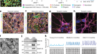 A model of human neural networks reveals NPTX2 pathology in ALS and FTLD