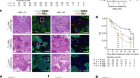 Anti-TIGIT antibody improves PD-L1 blockade through myeloid and Treg cells
