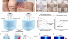 Injectable ultrasonic sensor for wireless monitoring of intracranial signals