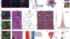 Multimodal decoding of human liver regeneration