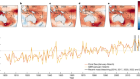 Highest ocean heat in four centuries places Great Barrier Reef in danger