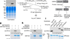 SMYD5 methylation of rpL40 links ribosomal output to gastric cancer