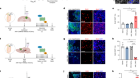 Histone serotonylation regulates ependymoma tumorigenesis