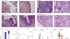 Gut microbiota carcinogen metabolism causes distal tissue tumours