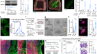 Neuronal substance P drives metastasis through an extracellular RNA–TLR7 axis