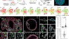 Human organoids with an autologous tissue-resident immune compartment