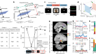 Abstract representations emerge in human hippocampal neurons during inference