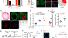 DNA-sensing inflammasomes cause recurrent atherosclerotic stroke