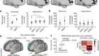 Frontostriatal salience network expansion in individuals in depression