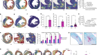 Spatially clustered type I interferon responses at injury borderzones