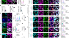 Lysosomes drive the piecemeal removal of mitochondrial inner membrane