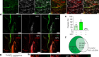 Sympathetic neuropeptide Y protects from obesity by sustaining thermogenic fat