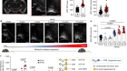 Pathogenic hypothalamic extracellular matrix promotes metabolic disease