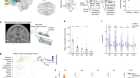 Single-neuron representations of odours in the human brain