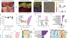 Spatial proteomics identifies JAKi as treatment for a lethal skin disease