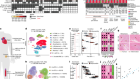 Immune responses in checkpoint myocarditis across heart, blood and tumour