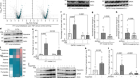 Aspartate signalling drives lung metastasis via alternative translation