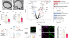 Glycocalyx dysregulation impairs blood–brain barrier in ageing and disease