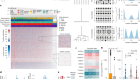 Fluctuating DNA methylation tracks cancer evolution at clinical scale