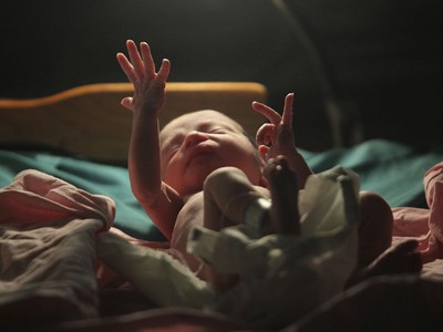 Survival Of The Littlest The Long Term Impacts Of Being Born Extremely Early