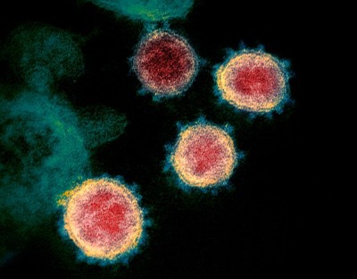 The Mathematical Strategy That Could Transform Coronavirus Testing