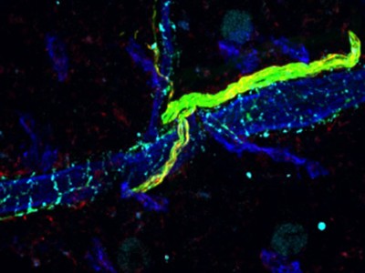 Pain-sensing neurons mobilize blood stem cells from bone marrow