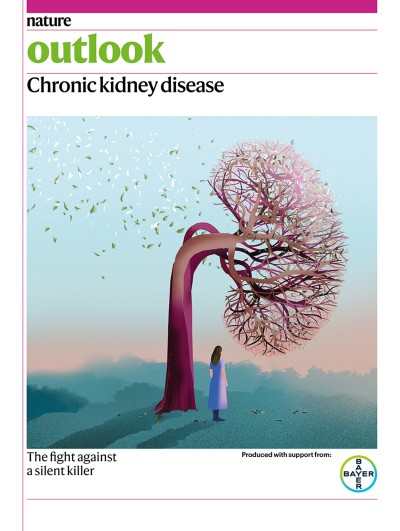 How organoids are advancing the understanding of chronic kidney disease 1