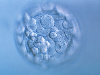 Why CRISPR babies are still too risky — embryo studies highlight challenges 3