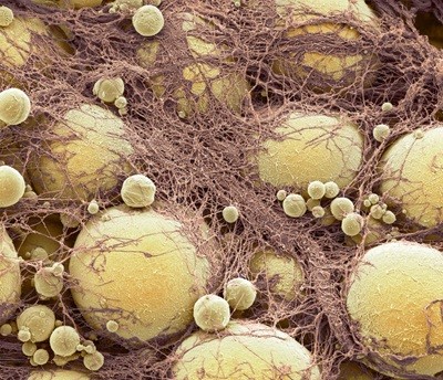 Neglected brown fat in our bodies linked to a wide range of health benefits